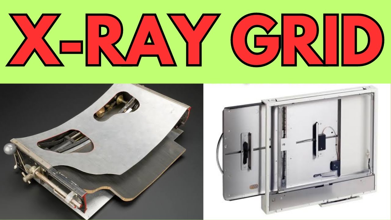 X-ray grid  | construction of X-ray grid | Grids in Radiology | anti-scatter grid | by prachi
