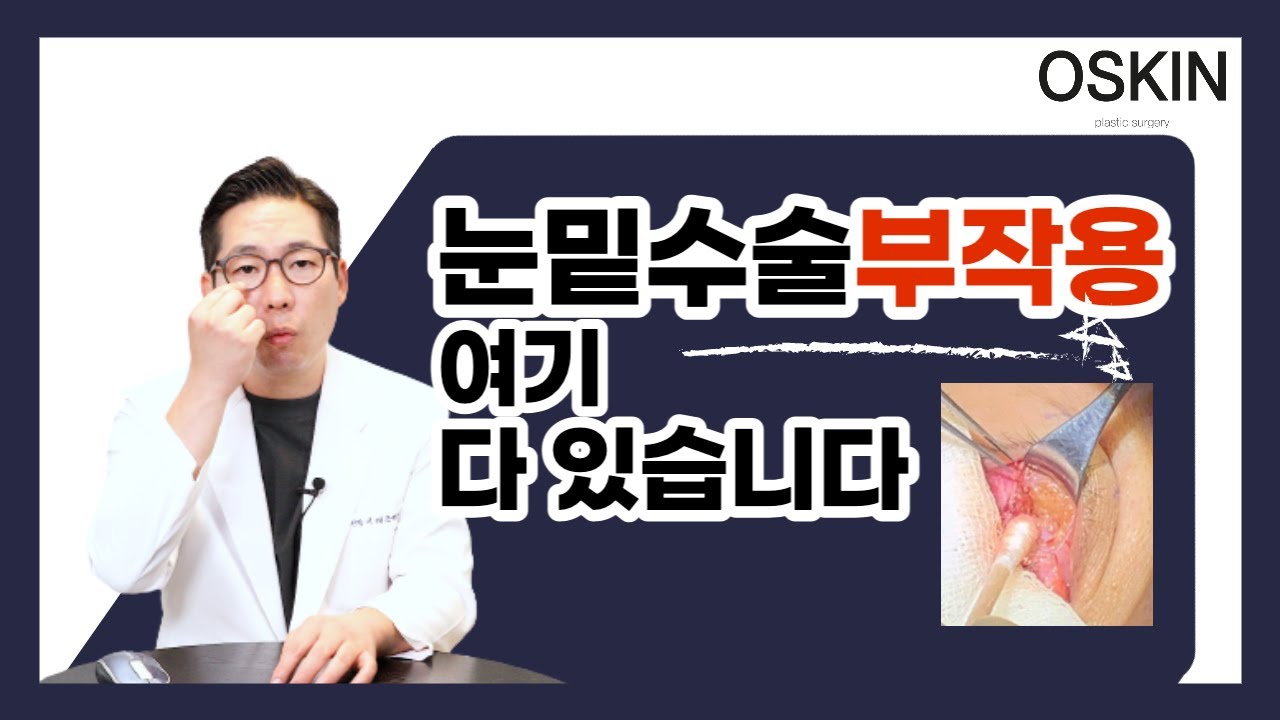 눈밑수술 대표 부작용 다 정리해드립니다(눈밑지방재배치)