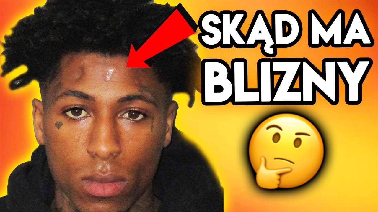 TRAP CIEKAWOSTKI #5🔥 SKĄD BLIZNY YOUNGBOYA NBA❓