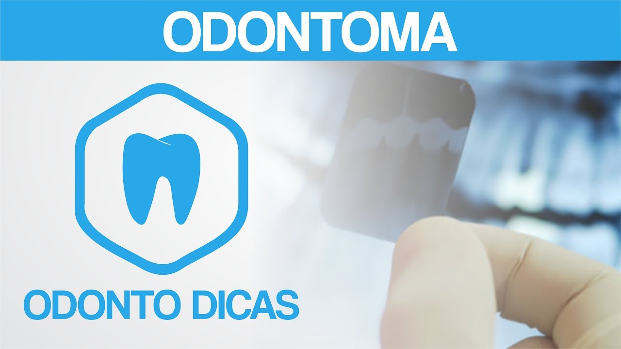 ODONTOMA | ODONTO DICAS