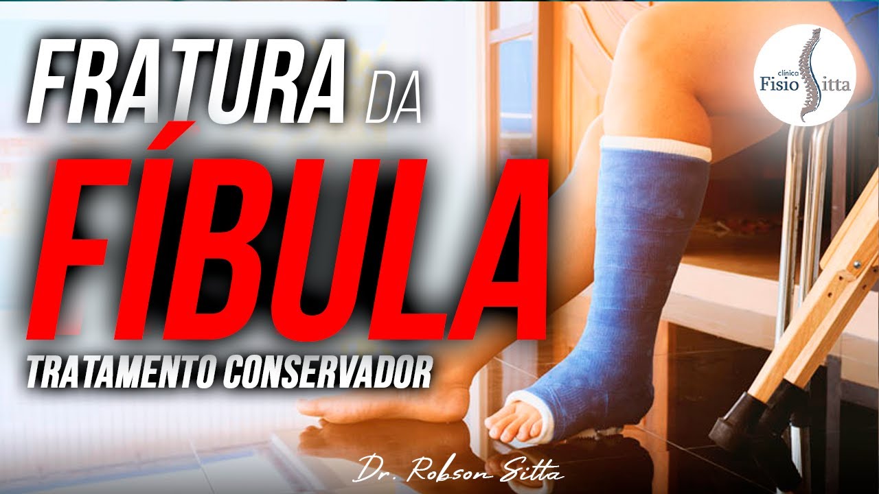 TRATAMENTO CONSERVADOR FRATURA DA FÍBULA DISTAL - Clínica de Fisioterapia Dr Robson Sitta