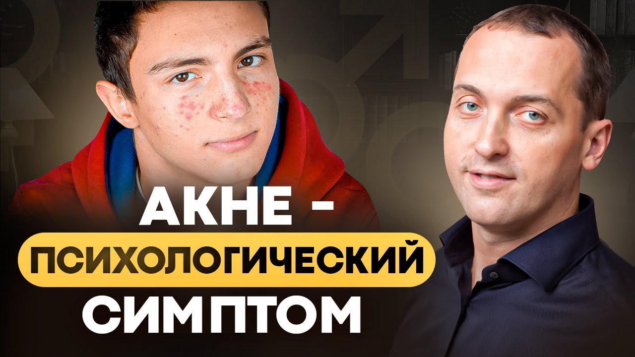 Лечение АКНЕ. Прыщи на лице и спине. ГЛАВНАЯ ПРИЧИНА проблем с кожей у подростков и взрослых.