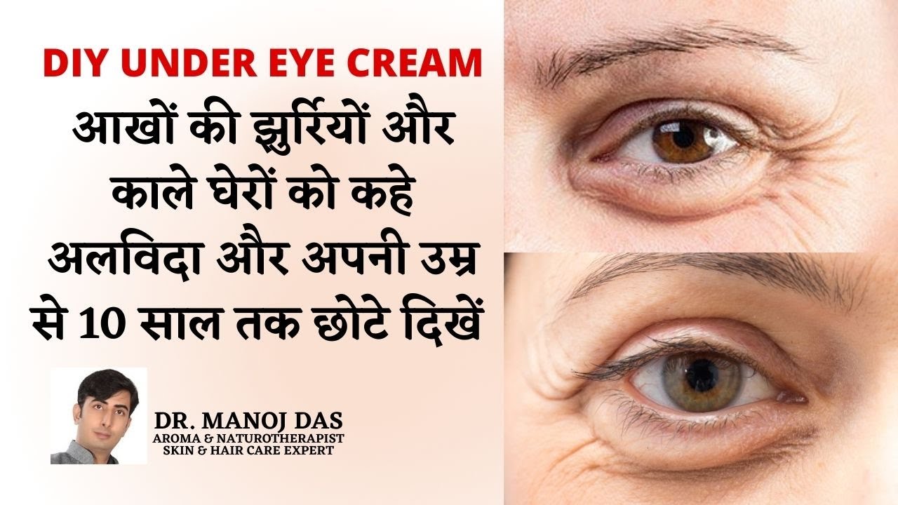 Dark circles, wrinkles removal, anti ageing eye cream DIY I homemade under eye gel I DR. MANOJ DAS