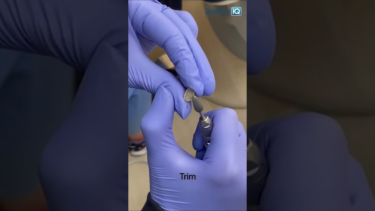 Temporary crown tips with Dr. Tami #shorts