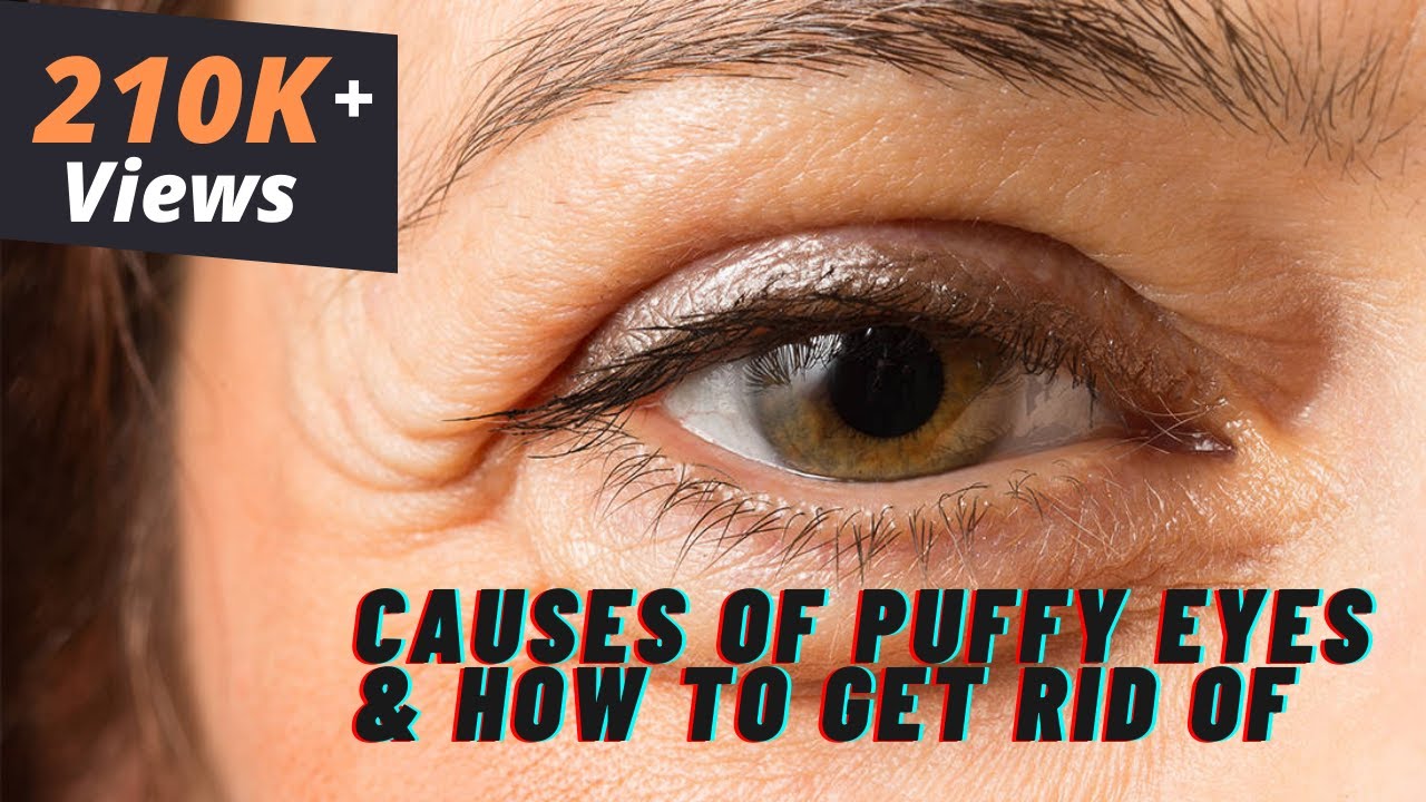 What Causes Puffy Eyes & How to Get Rid of it | Cosmetic Expert Dr. Debraj Shome Explains