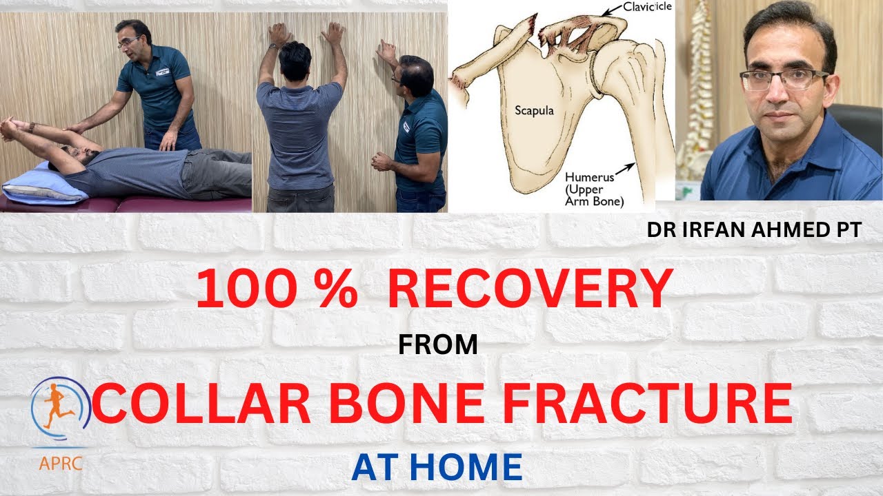 learn  Everything  About Clavicle Fracture Recovery , Exercises & Rehabilitation at Home Urdu| Hindi