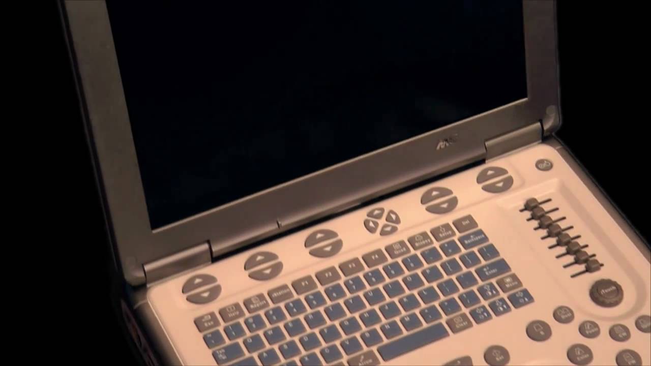 Mindray M5 Portable Ultrasound Review