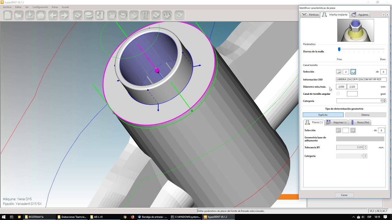 HYPERDENT - 9 - Barra de implantes con metadatos