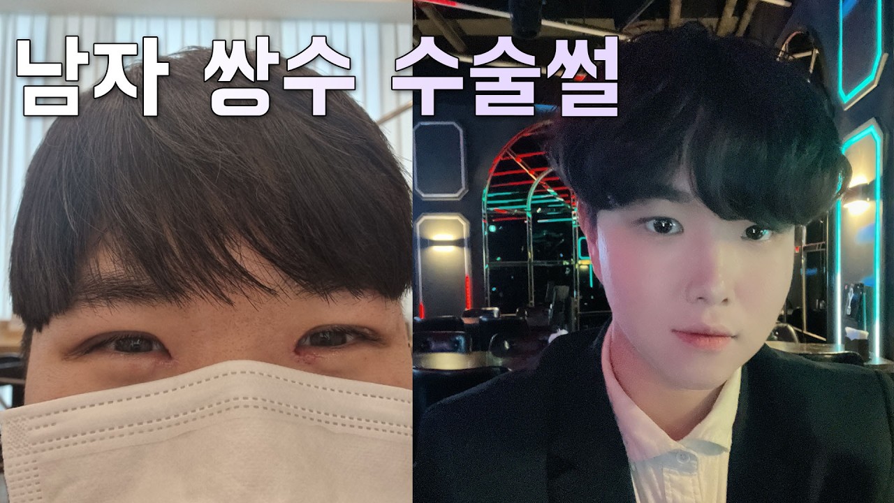 여자꼬실려고 쌍수 했다가 ㅈ망한썰