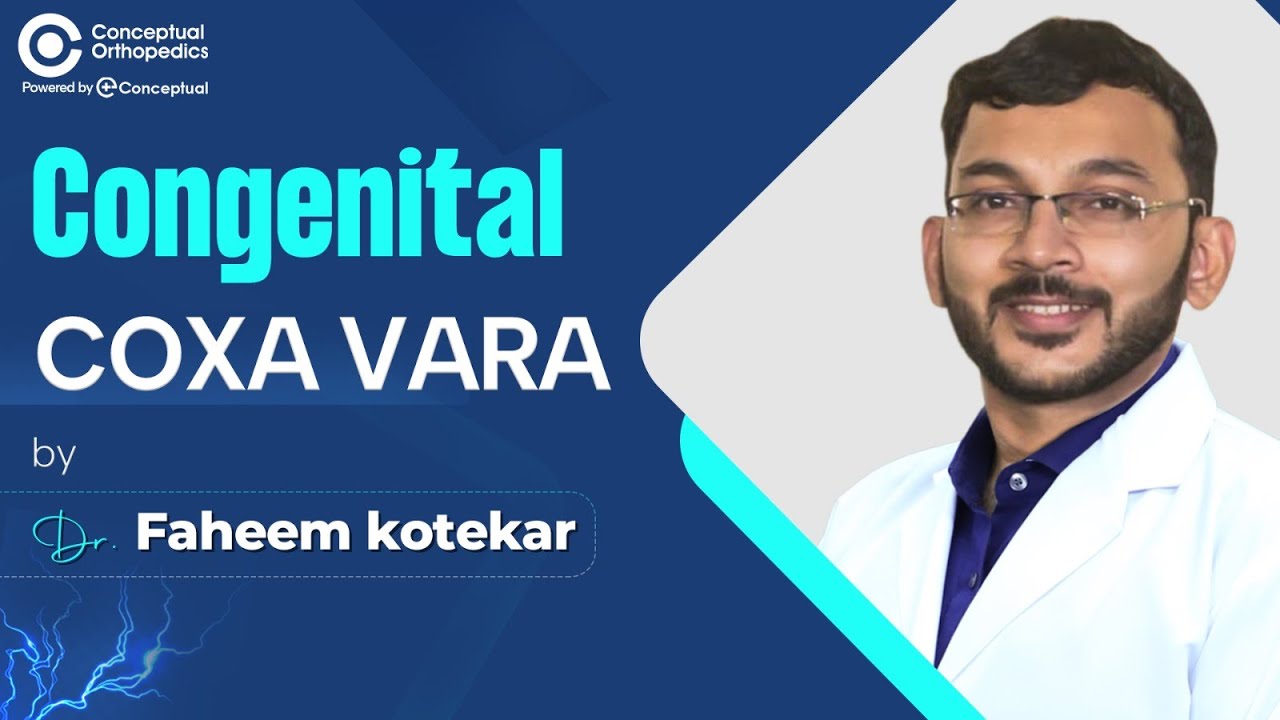 Understanding Congenital Coxa Vara: Diagnosis, Clinical Features, and Treatment Options | Dr Faheem