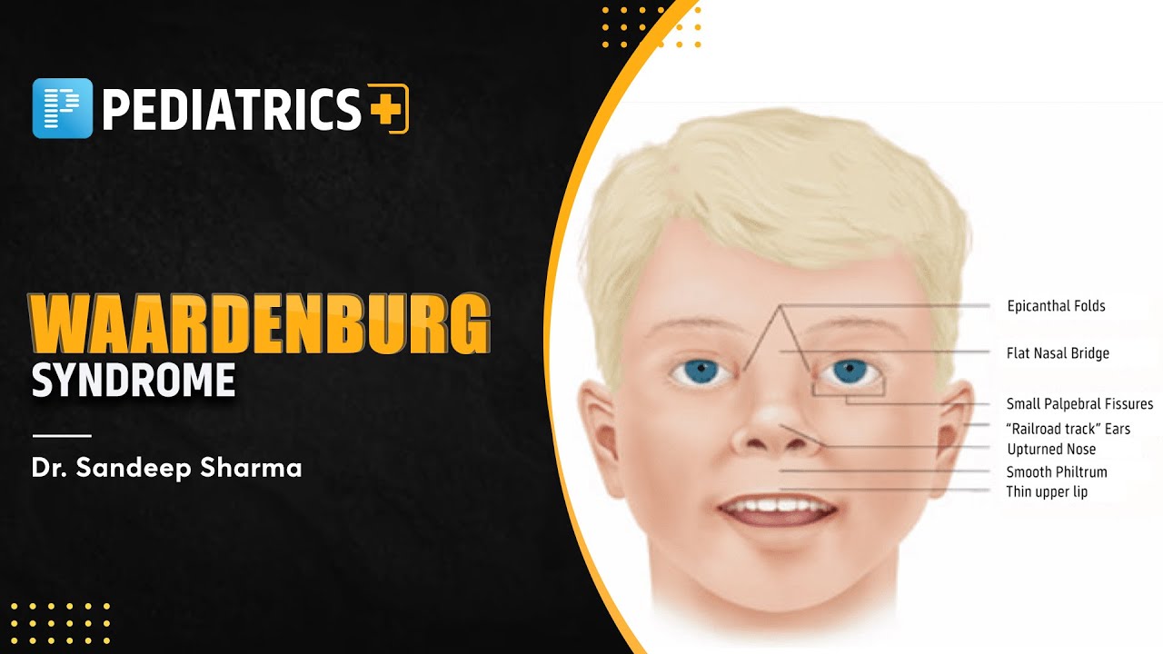Waardenburg Syndrome [General Pediatrics] - PrepLadder NEET SS
