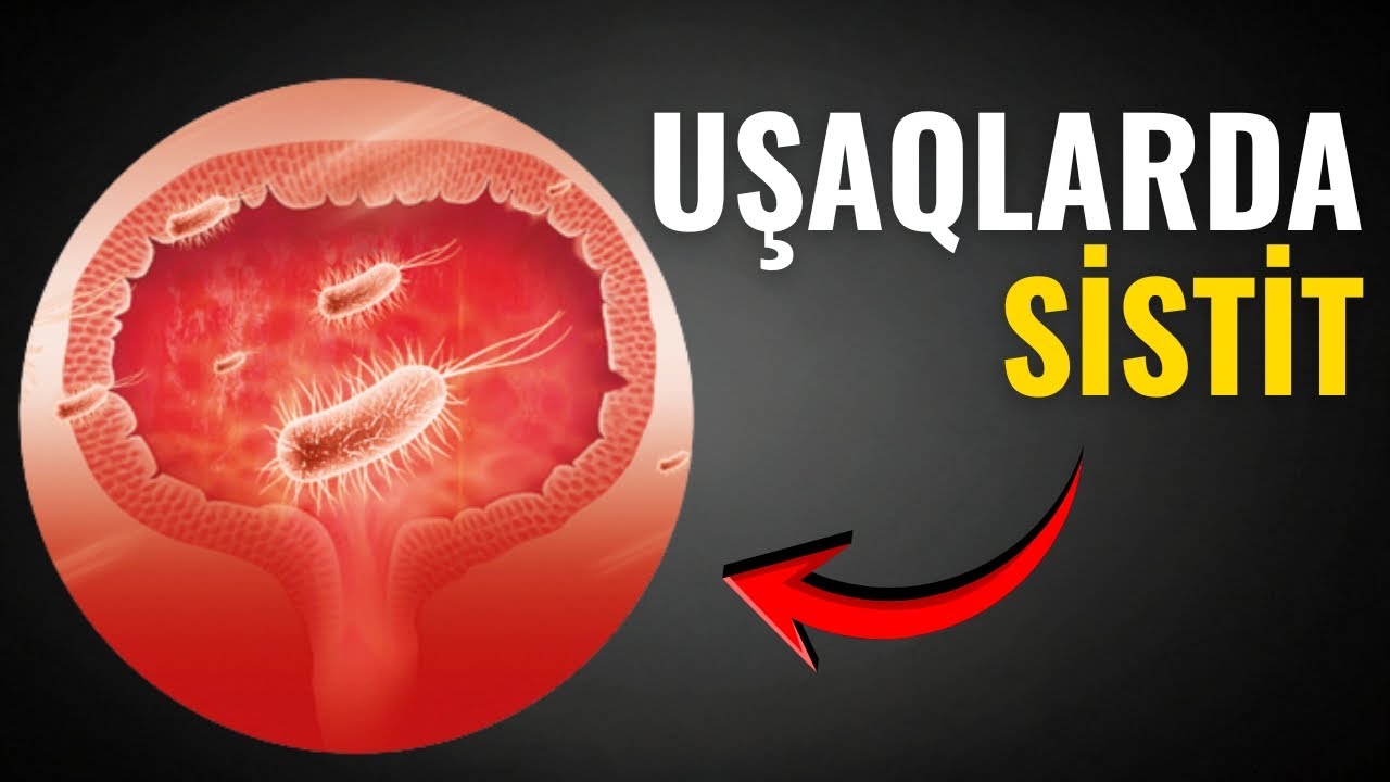 Uşaqlarda sistit nədir və niyə yaranır? VALİDEYNLƏR DİQQƏT!