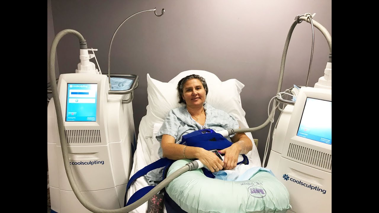 CoolSculpting and PAH