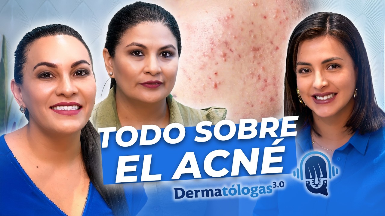 Todo lo que necesitas saber sobre el acné, explicado por expertas Podcast Ep  1   Dermatólogas 3 0