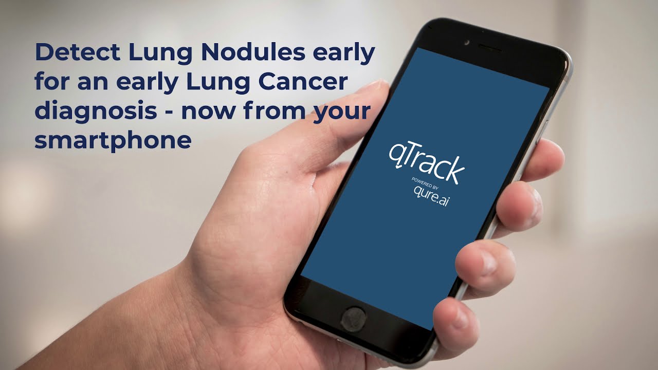 qTrack for Lung Nodules -  End-to-End Disease Management using Artificial Intelligence Algorithms