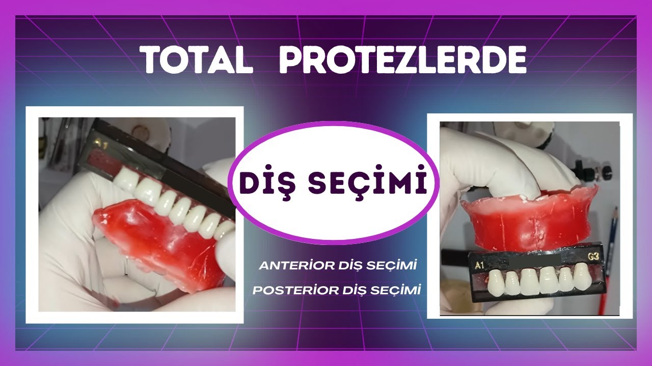 Total protezlerde diş seçimi
