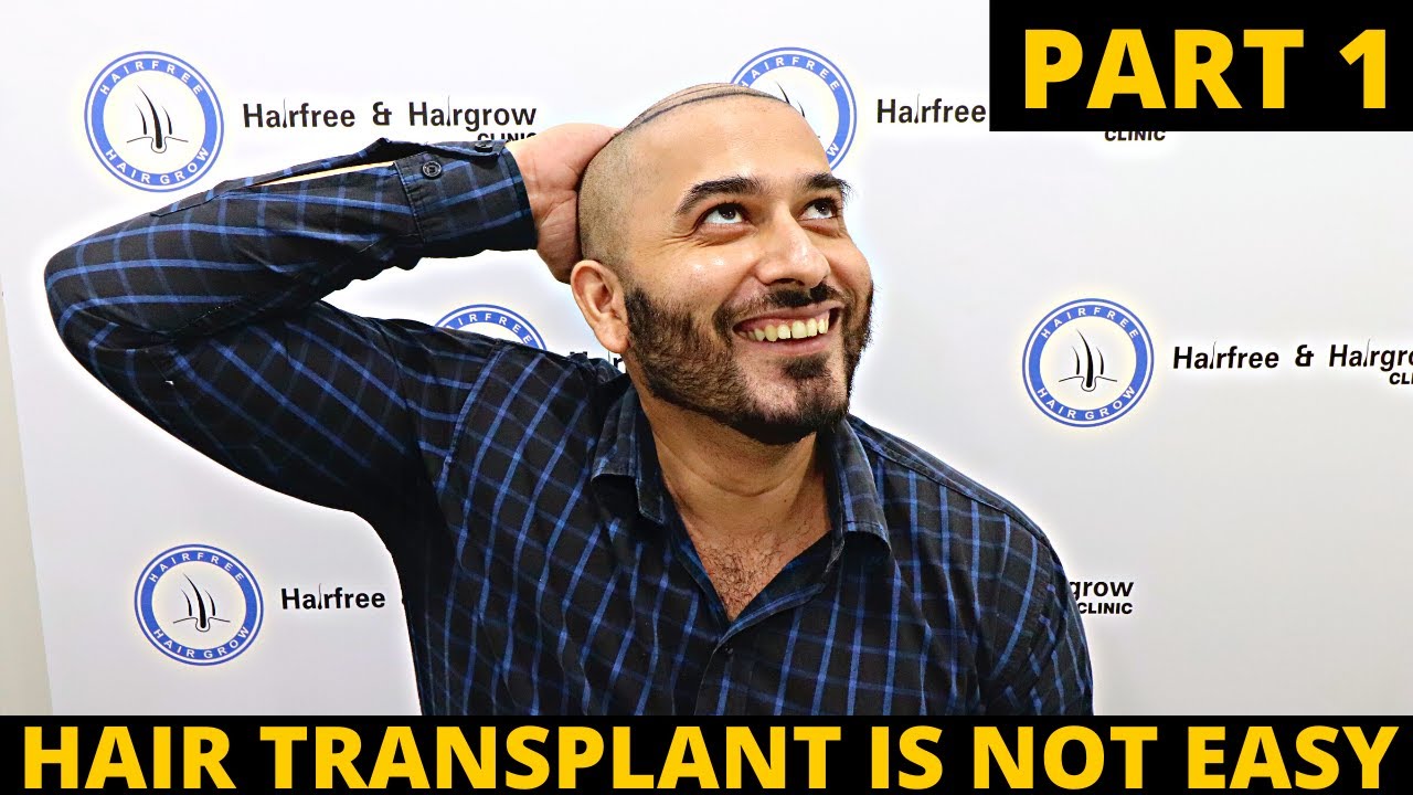 Finally Removed All my Hair | First day of hair transplant | Born Creator