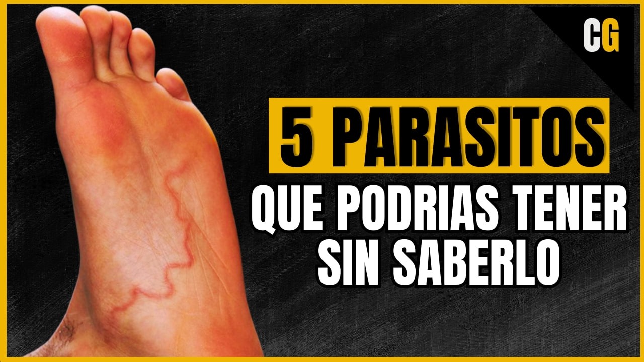 Top 5 Par&aacute;sitos mas SIGILOSOS - Parasitos que Podrias tener sin saberlo