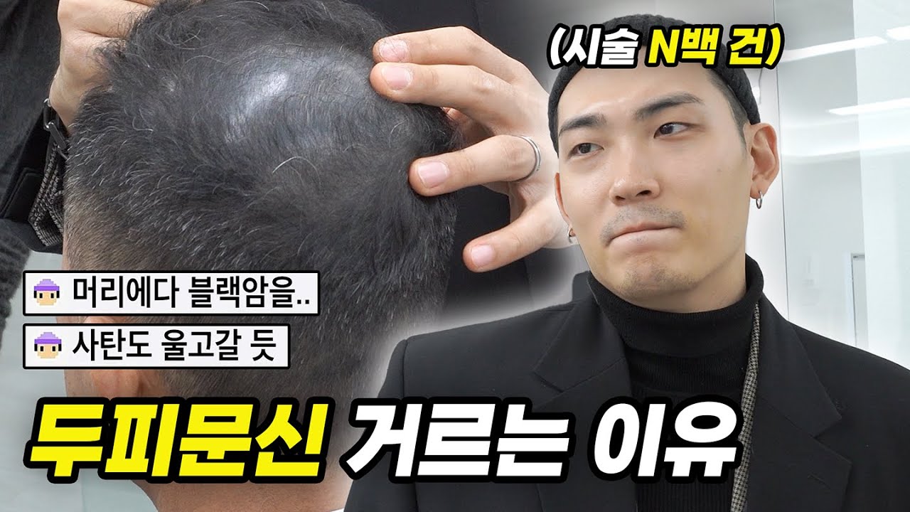 대체 어디서 이렇게 받아오신 거예요?? 머리에다 블랙암을 박아놨네;; | 두피문신 고민중이라면 필수시청