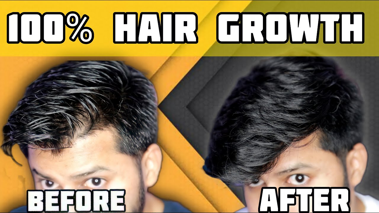 Best Hair Growth Technique | இத follow பண்ணா கண்டிப்பா முடி வளரும் | Tamil | Shadhik Azeez