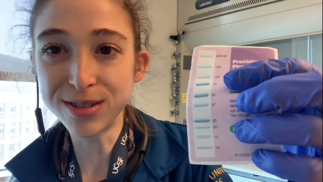 Gel ladders - tips and tricks for using molecular weight markers
