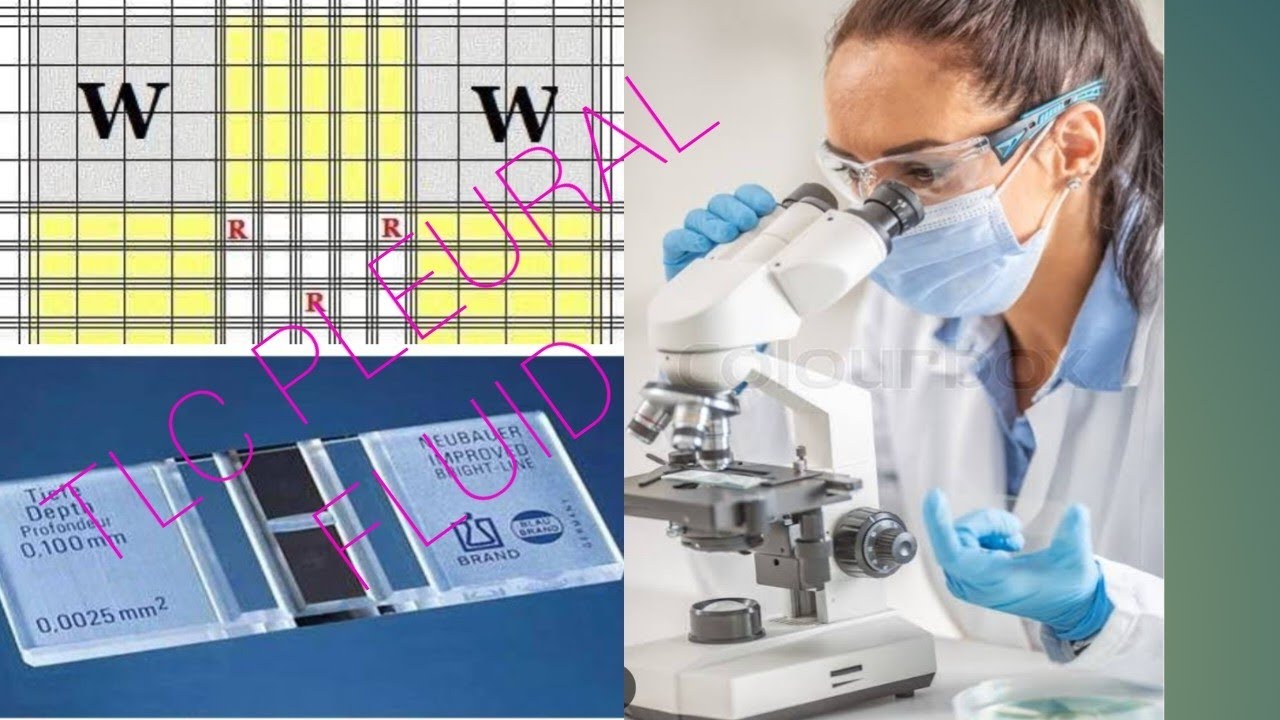 TLC pleural fluid Neubauer chamber, pleural fluid examination,TLC for blody fluid#drnajeeb#labtech