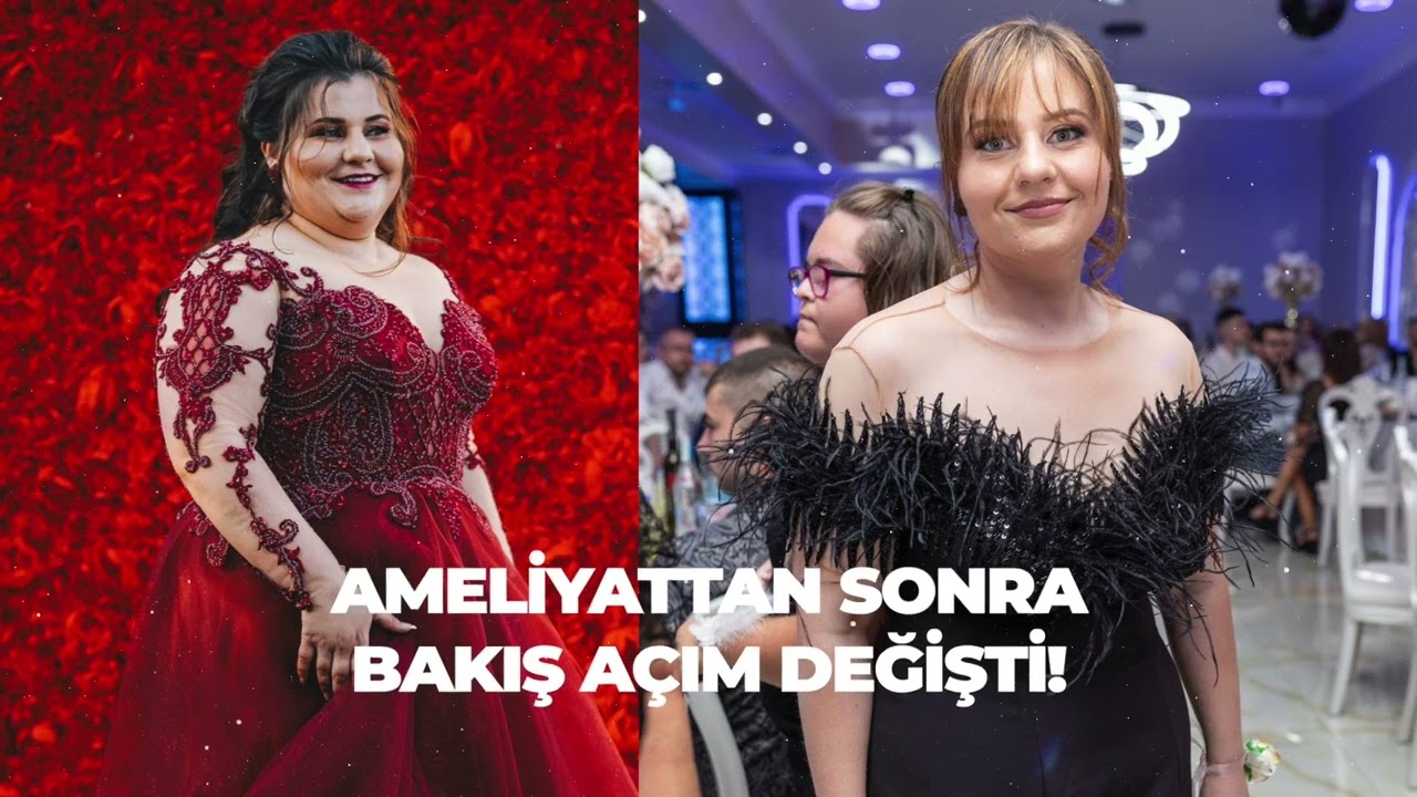 Tüp mide ameliyatından sonra hayatımda her şey değişti! Almanya’dan gelen Sibel Hanım’ın Hikayesi…