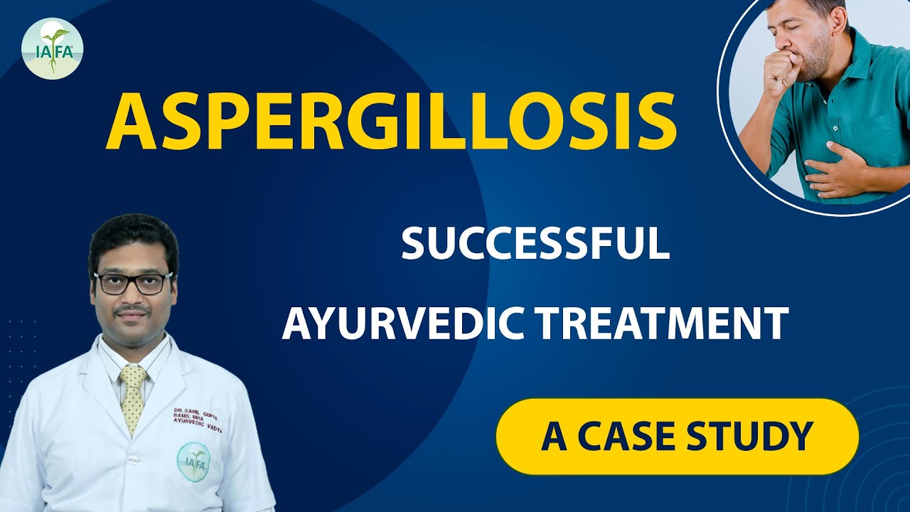 Aspergillosis Treatment in Ayurveda | CHRONIC ASPERGILLOSIS OF PARANASAL SINUSES  | A Case Study