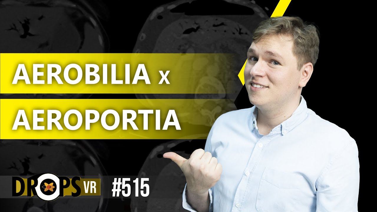 AEROBILIA X AEROPORTIA: COMO DIFERENCIAR
