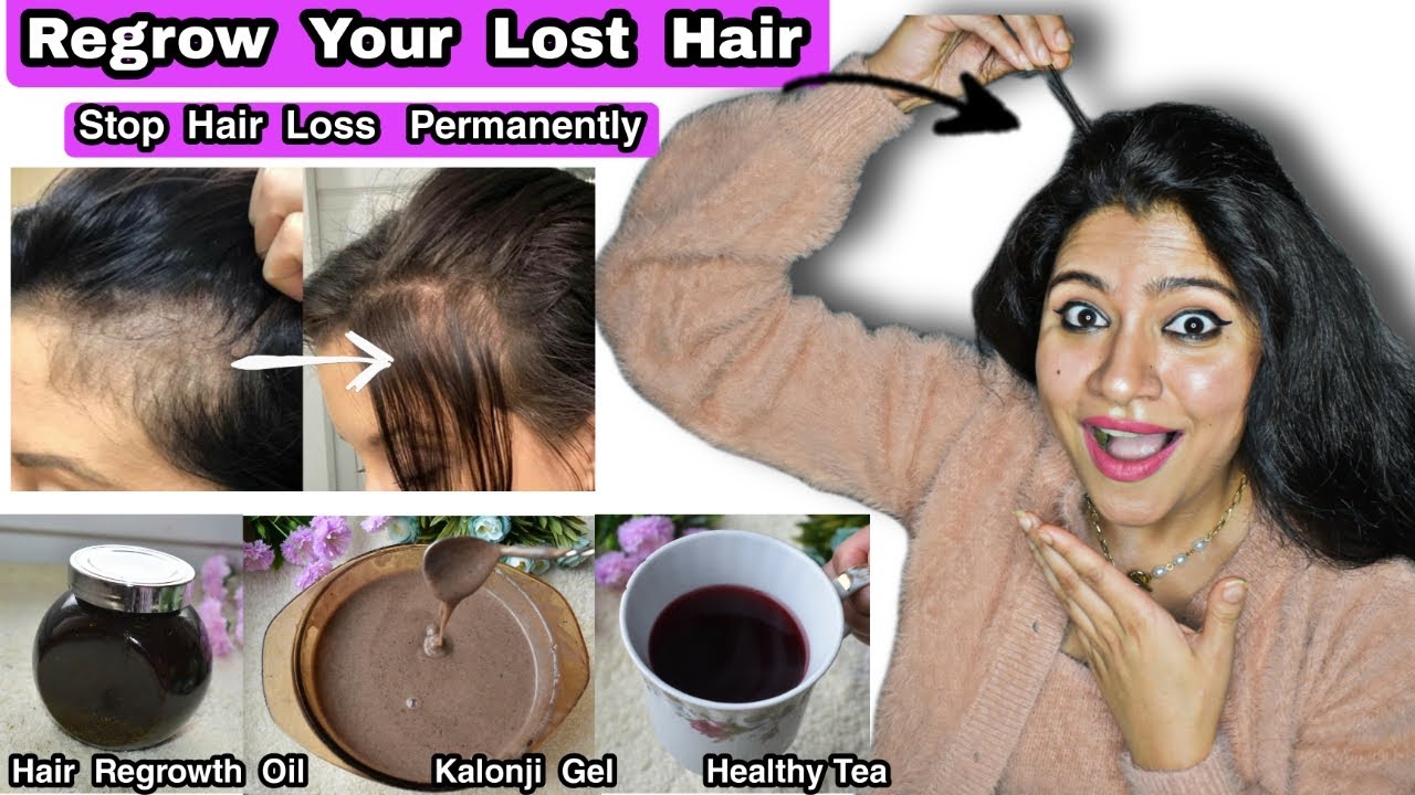 Hair Regrowth Challenge : 3 - Steps To Regrow  Your Lost Hair Naturally खोये हुए बाल वापस उगायें।