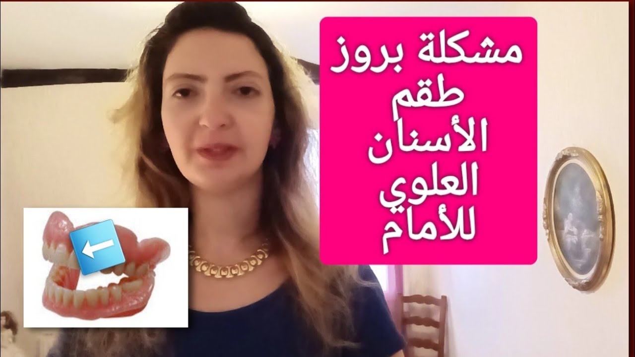 مشكلة بروز طقم الأسنان العلوي للأمام (ضب للأمام) و الحل#طقم_الأسنان#تركيبات_الاسنان