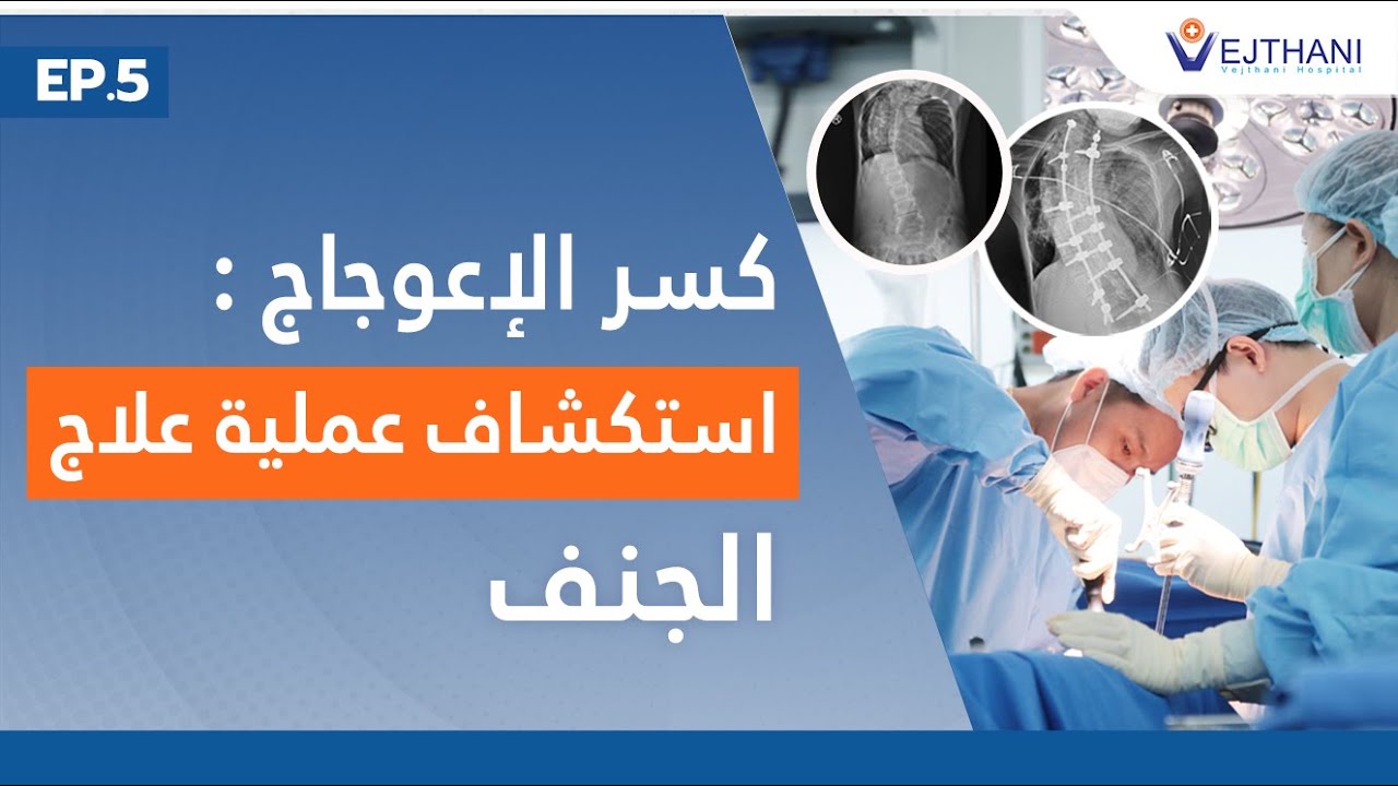 كسر الإعوجاج : استكشاف عملية علاج الجنف : EP 5