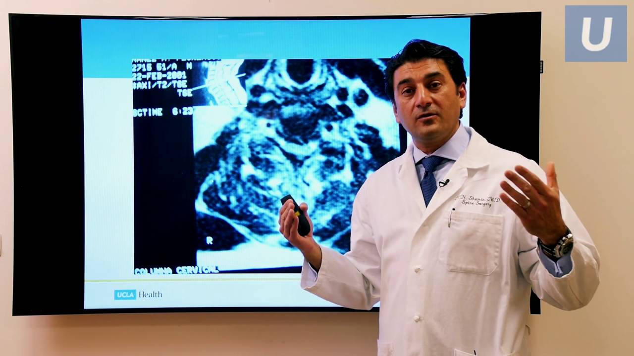 Novel Treatments in Spinal Surgery | Nick Shamie, MD | UCLAMDChat