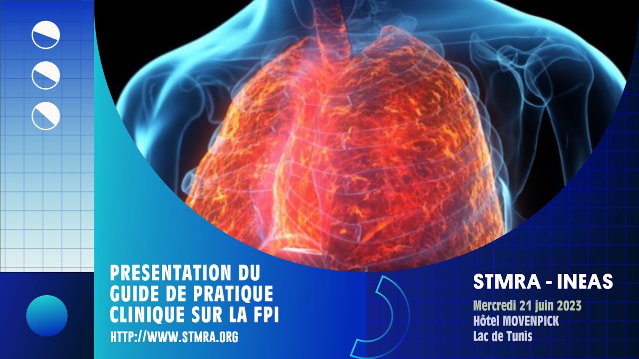 Pr&eacute;sentation du Guide sur la FPI d&eacute;velopp&eacute; par la STMRA 2023