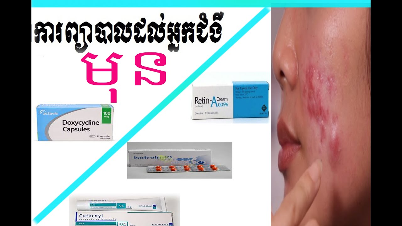 ការព្យាបាលជម្ងឺមុន​ ( Acne treatment  )