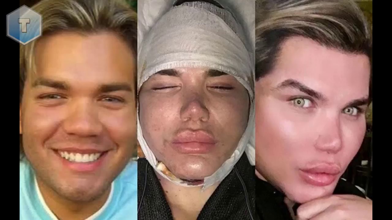 Conheça o Ken Humano - Rodrigo Alves