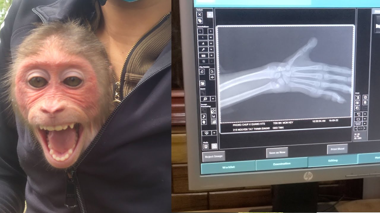 Monkey Kuku went for an x ray on his arm