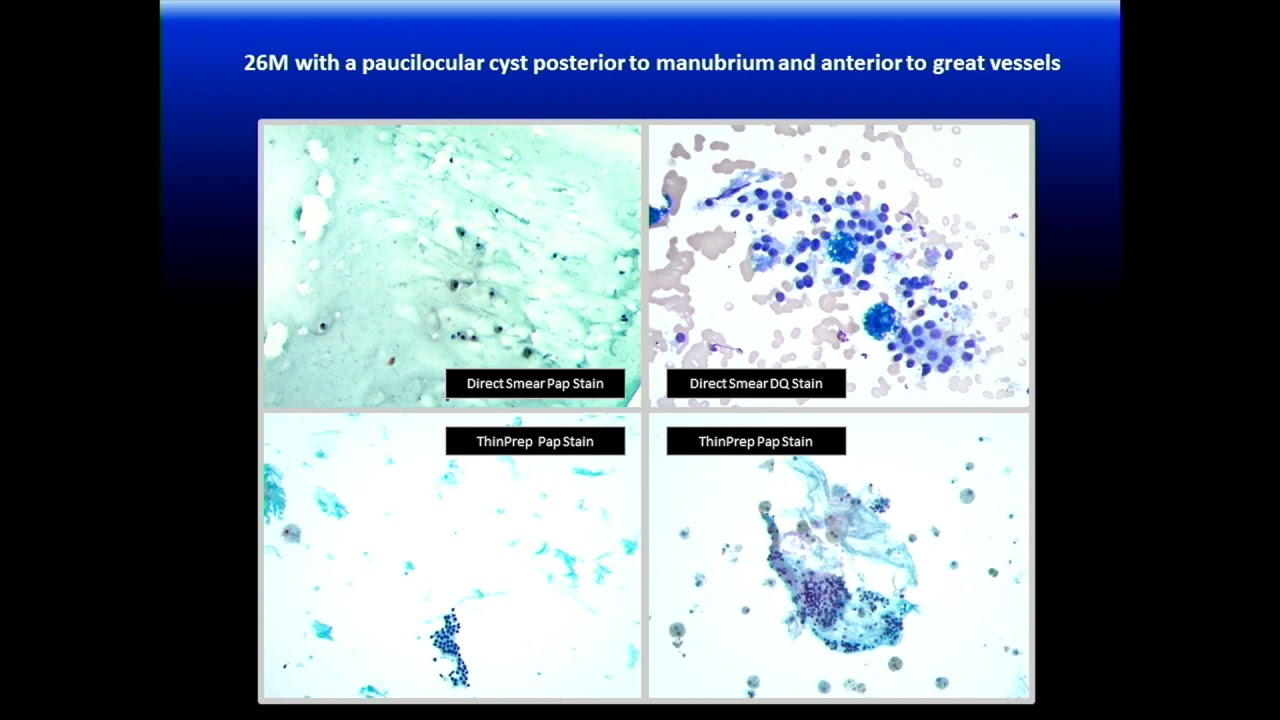 Classic Lectures in Pathology: What You Need to Know: Lung - A CME Teaching Activity