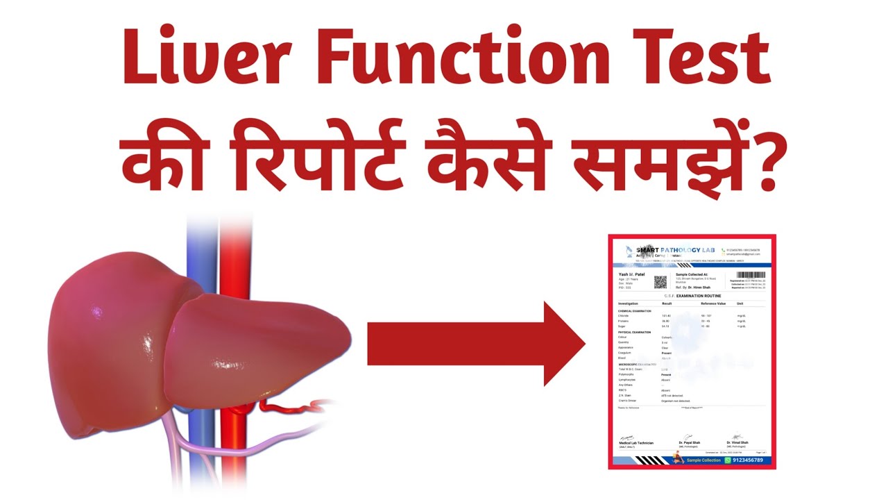 Liver Function Test Reports Analysis in Hindi || LFT Report