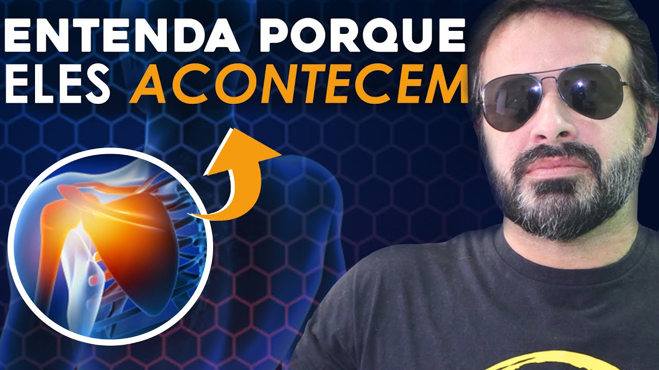 ACIDENTES ANATÔMICOS DA ESCÁPULA: NÃO DECORE, ENTENDA PORQUE ELES ACONTECEM