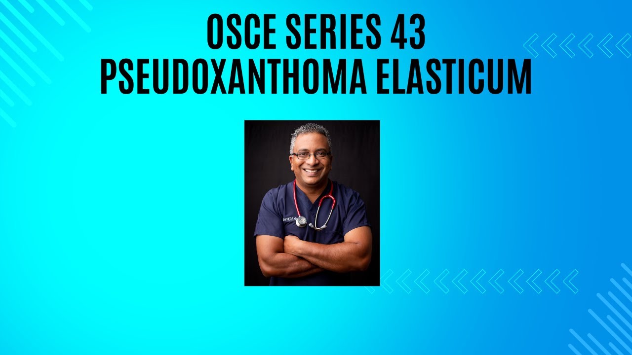 OSCE Series Episode 43 : Pseudoxanthoma Elasticum