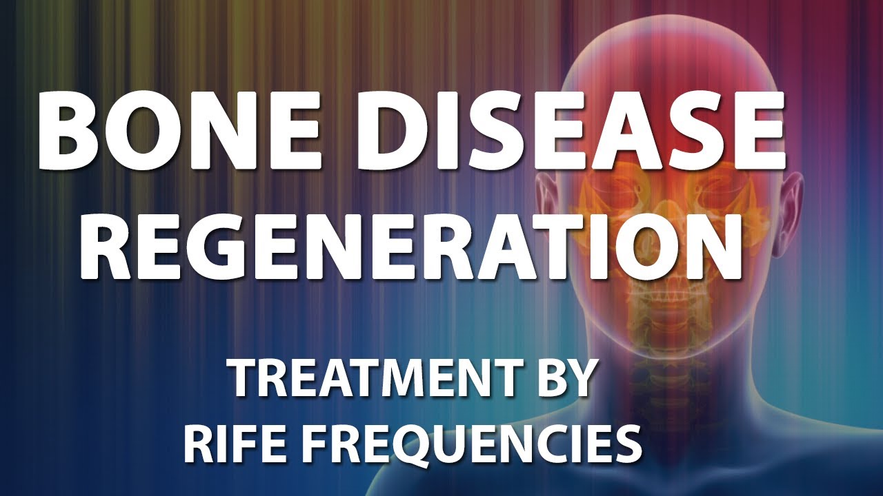 Bone Disease & Regeneration - RIFE Frequencies Treatment - Quantum Medicine with Bioresonance