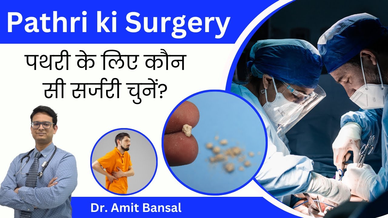 ✅ Pathri Ka सही इलाज: Laser, PCNL, Ya RIRS? I  | ✅ Kaun Si Surgery Aapke Liye Sahi Hai?