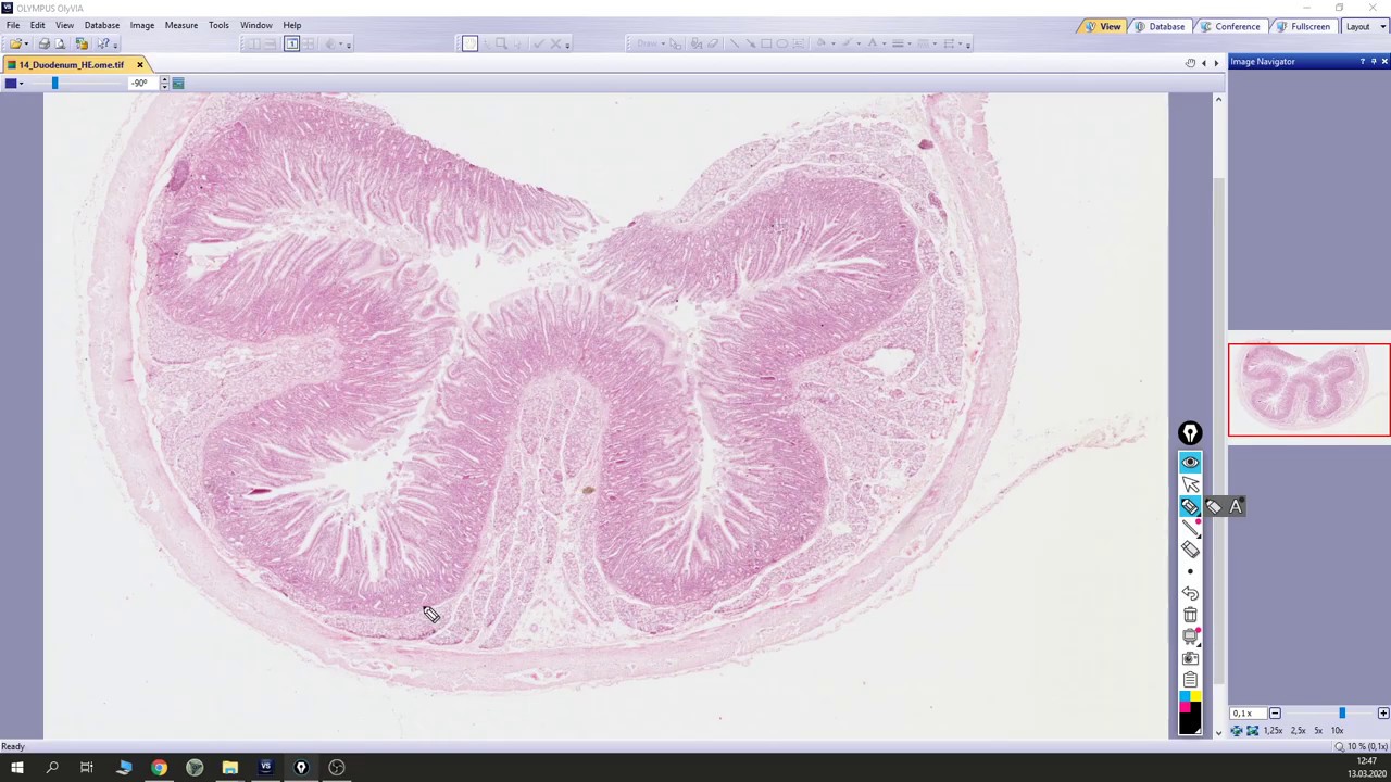 Duodenum (dvanáctník)
