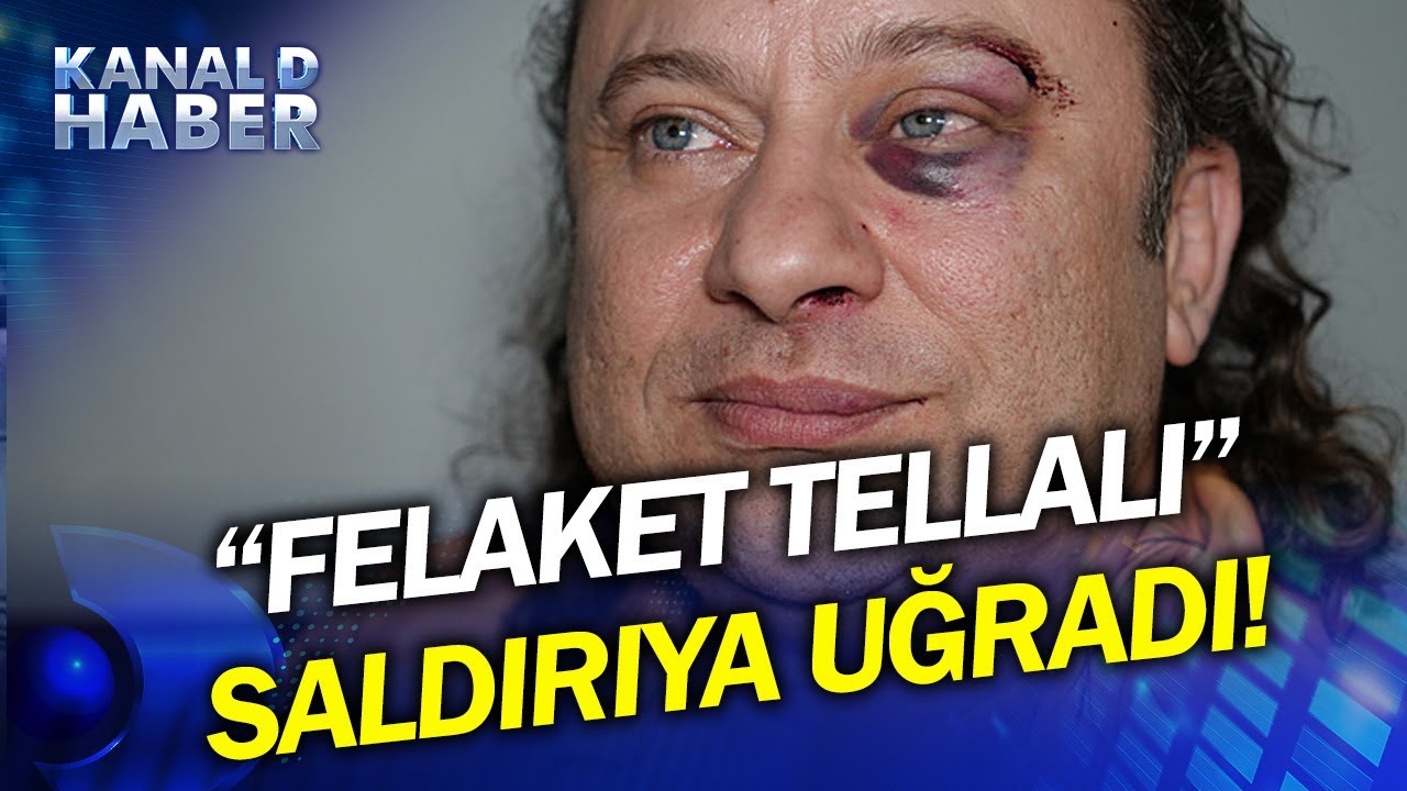 Türk Sanat Müziği Sanatçısı Onur Akay'a Korkunç Saldırı! Tanınmaz Hale Geldi...