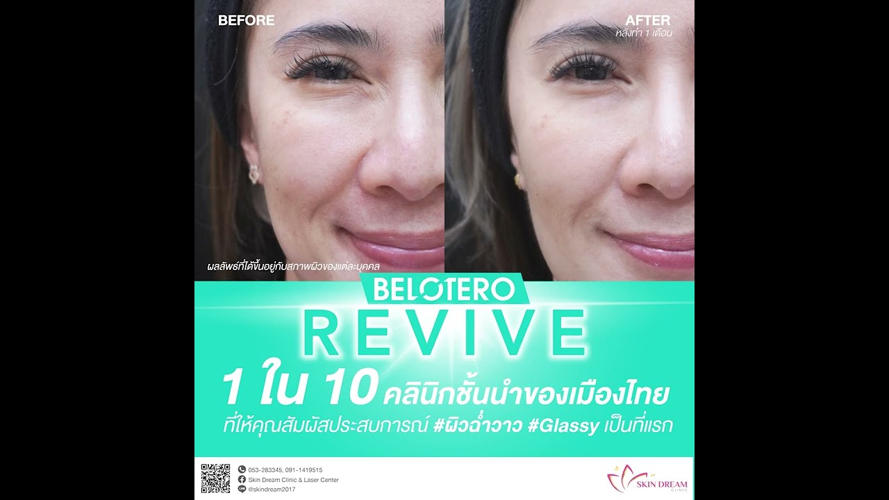 🫧Revive เผยผิวเรียบเนียน ฉ่ำวาว แบบ Glassy skin💓