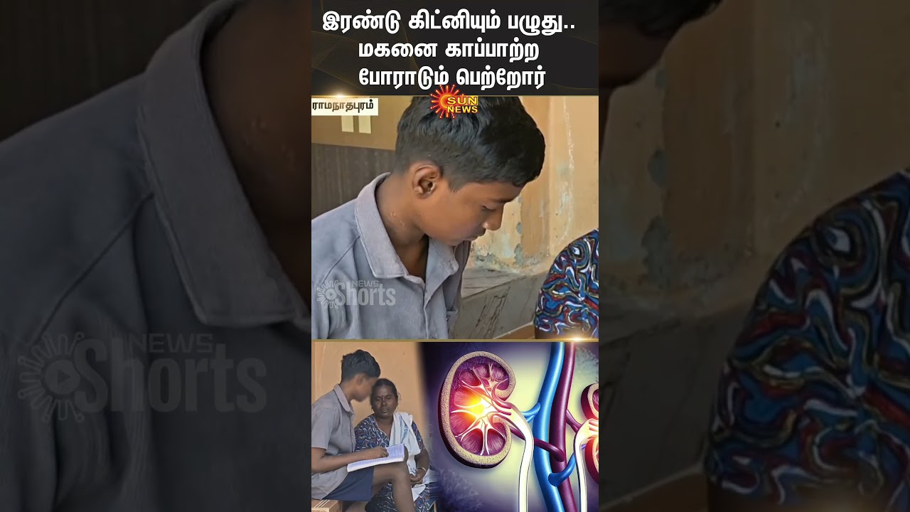 Parents fighting for a son | Two Kidney Failure | Request to TN Govt | Treatment | Sun News