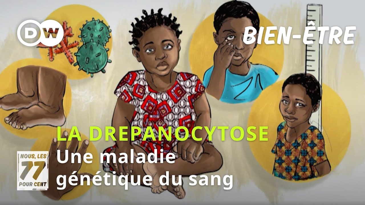 La dr&eacute;panocytose : une maladie du sang h&eacute;r&eacute;ditaire