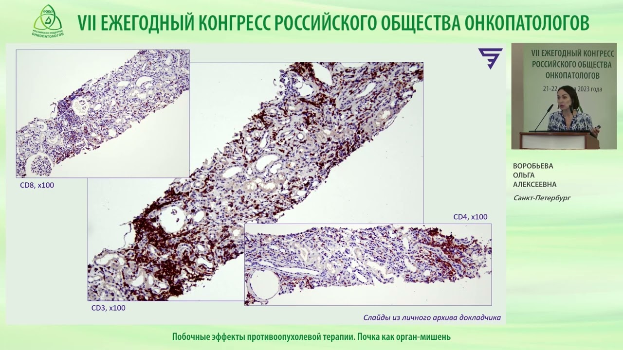 Побочные эффекты противоопухолевой терапии. Почка как орган-мишень