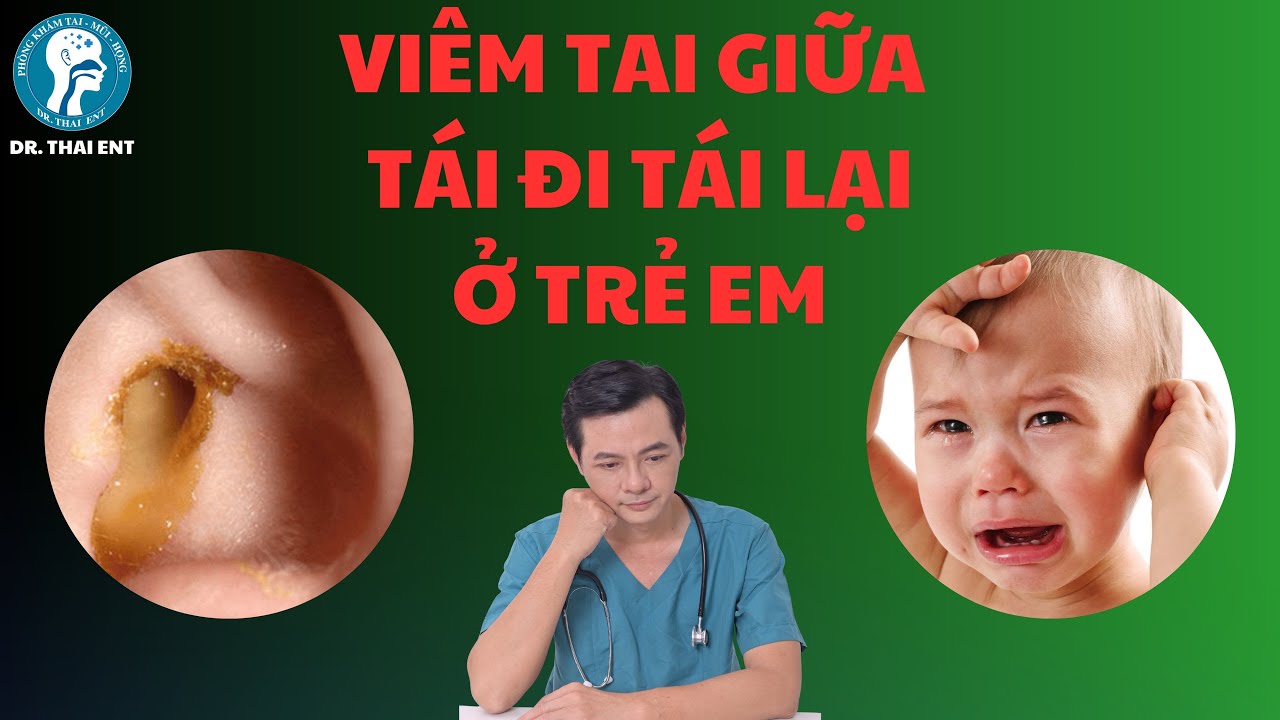 Viêm tai giữa tái đi tái lại ở trẻ em